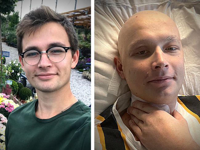 Karol z Jasieńca walczy o życie